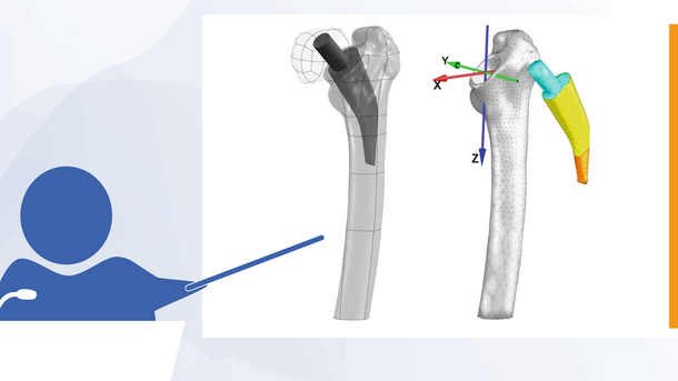 Symbolic picture: Presentation with photo of hip bone